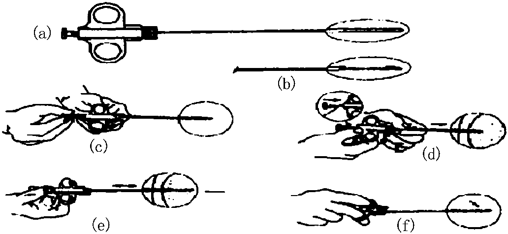 第八節(jié) 經(jīng)皮穿刺活檢術(shù)
